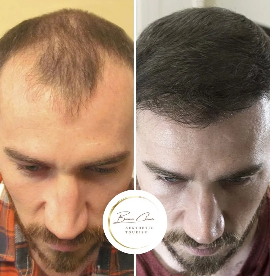 Kui te olete unistanud alati paksudest, tervetest juustest, mis suurendavad enesekindlust, siis .jpg