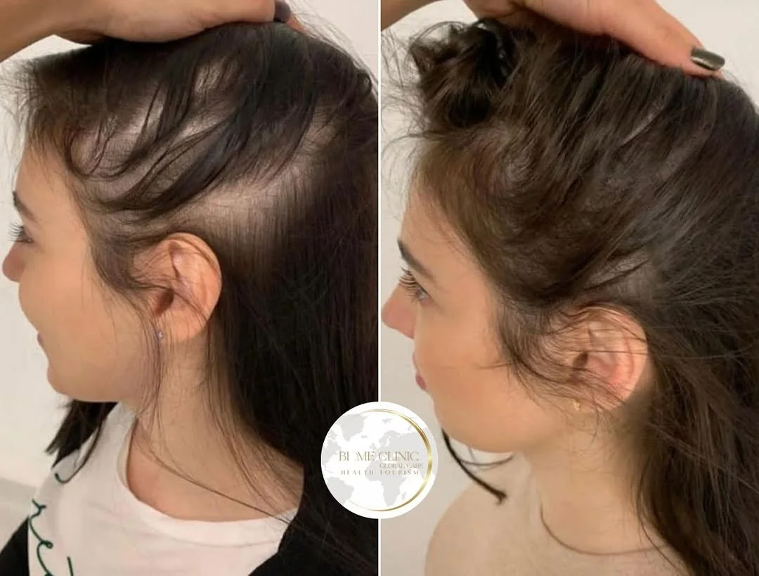 Juuste siirdamine on muutumas aina populaarsemaks lahenduseks, pakkudes võimalust saada tagasi t.jpg