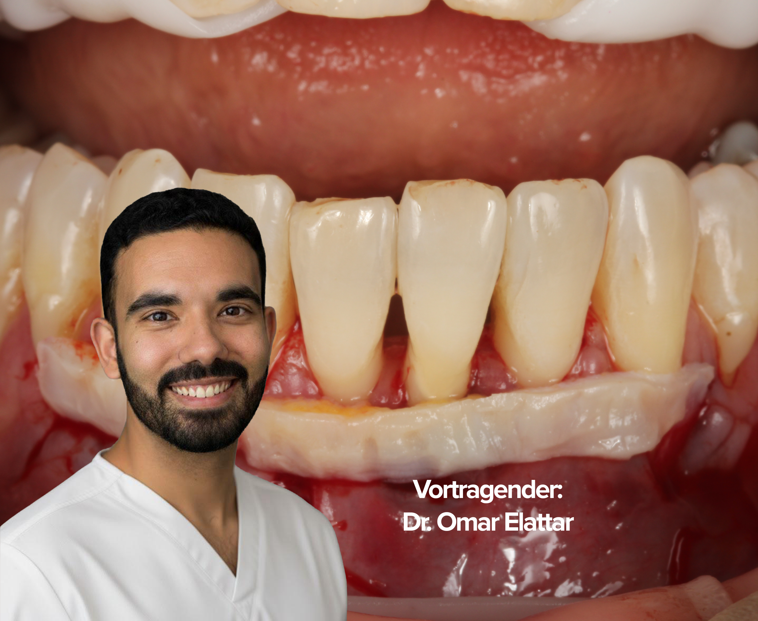 Rezessionsdeckung | Grundlagen und Techniken | Hands-on | 06.–07. November 2026