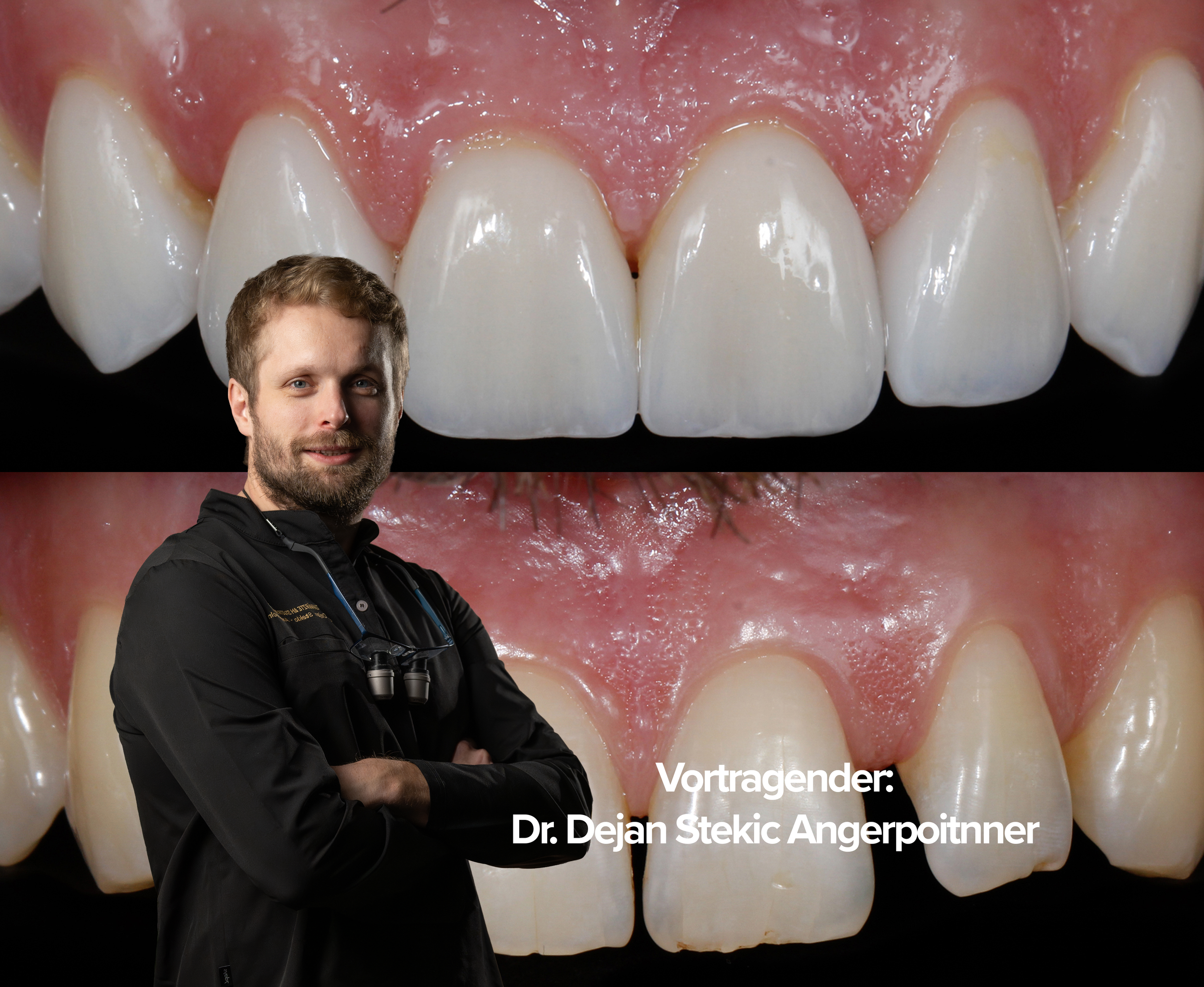 Smile Design und Veneers von A bis Z - 12. und 13. Juni 2026