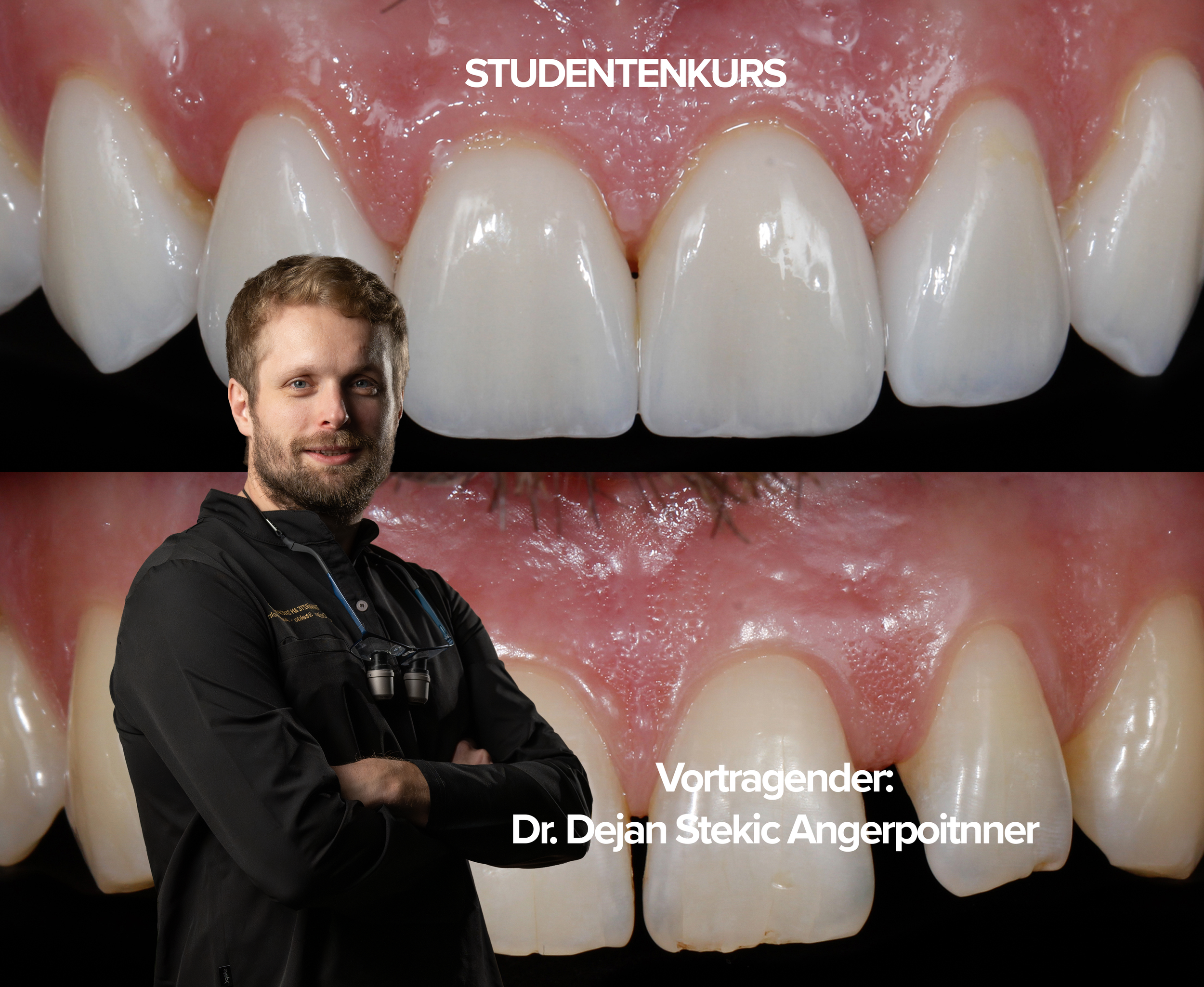 STUDENTENKURS | Smile Design und Veneers 100% Hands-on | 13. Juni 2026