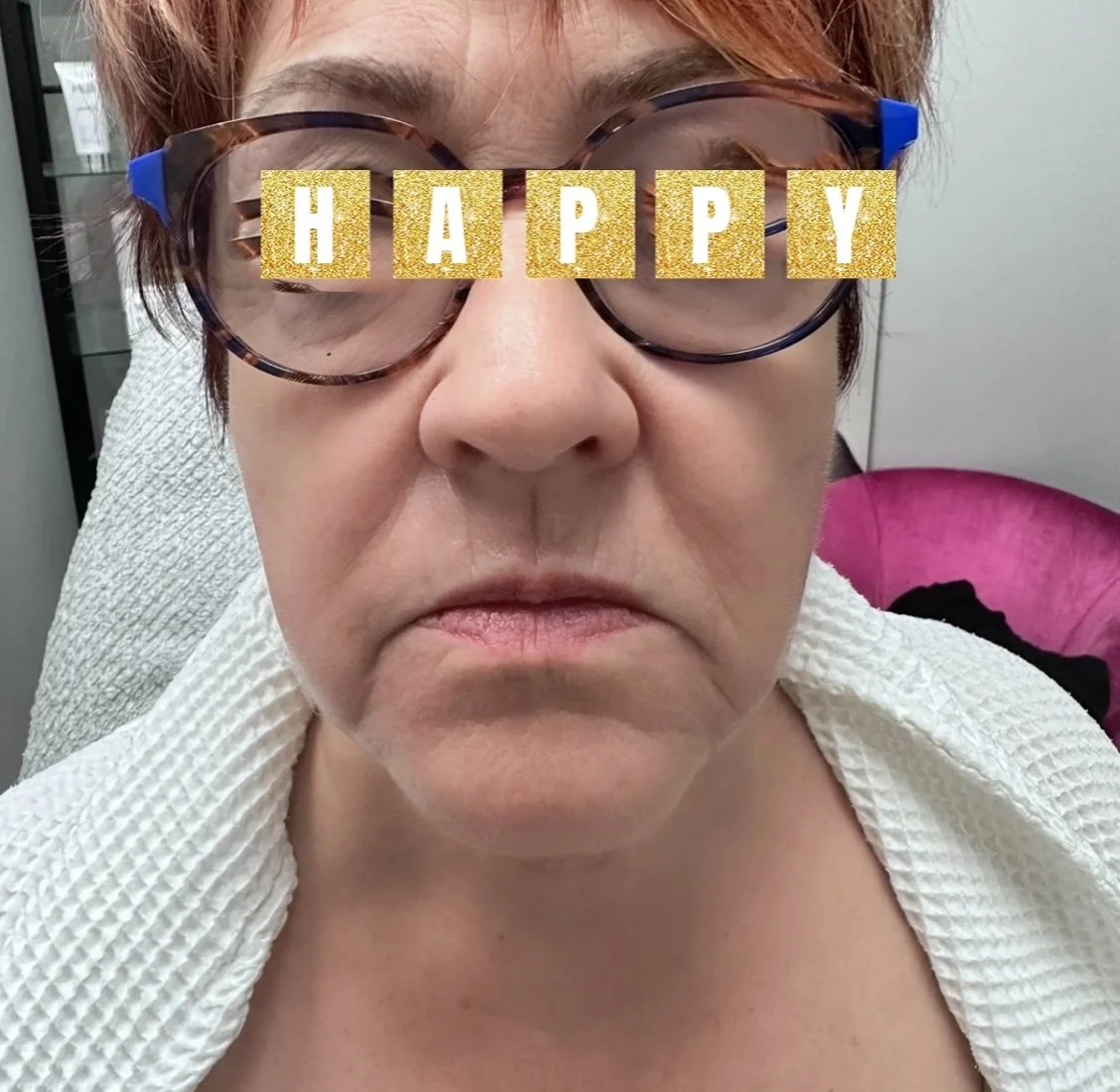 Plexr Plasma/Medical Grade Peels
(Fine Lines, Wrinkles, Skin Tightening, Contouring.)