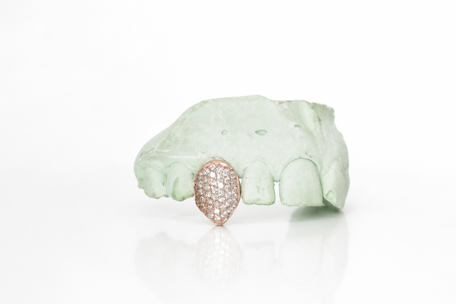 Goldteethgallery_Website-46.png