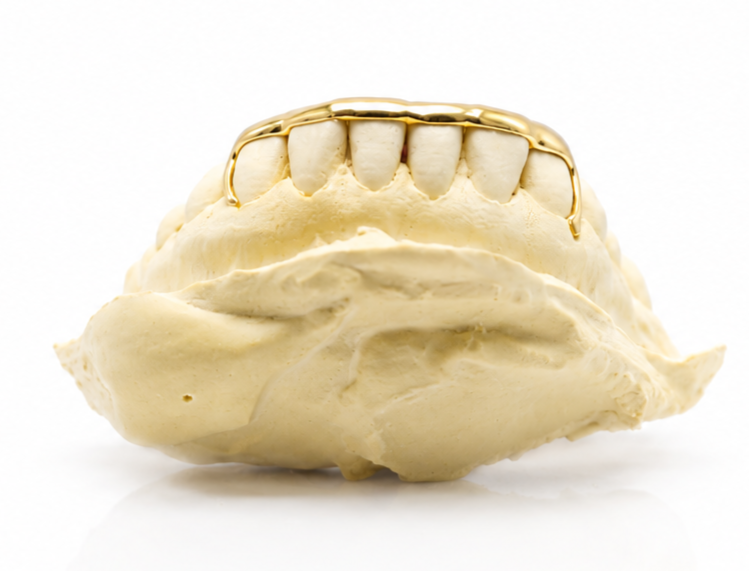 Goldteethgallery_Website_grillz_65.png