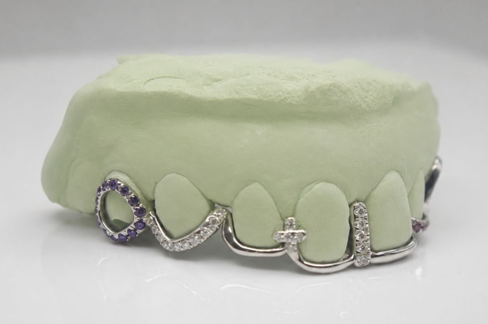 Goldteethgallery_Website_grillz_53.png