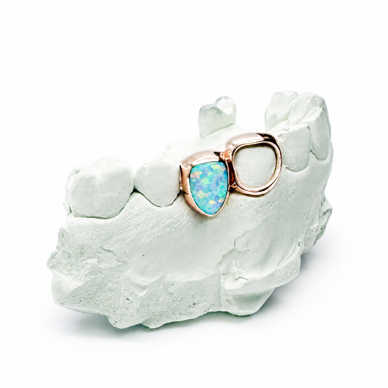 Goldteethgallery_opalgrillz_.png