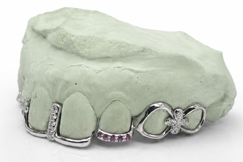 Goldteethgallery_Website_grillz_54.png