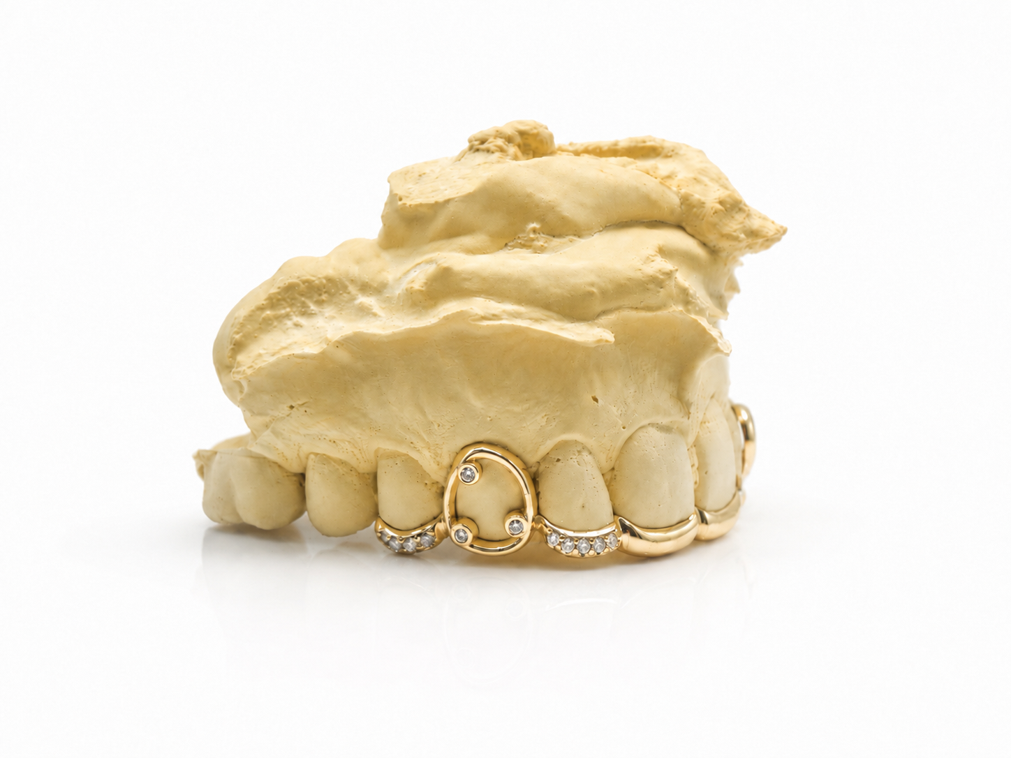 Goldteethgallery_Goldgrillz_13.png