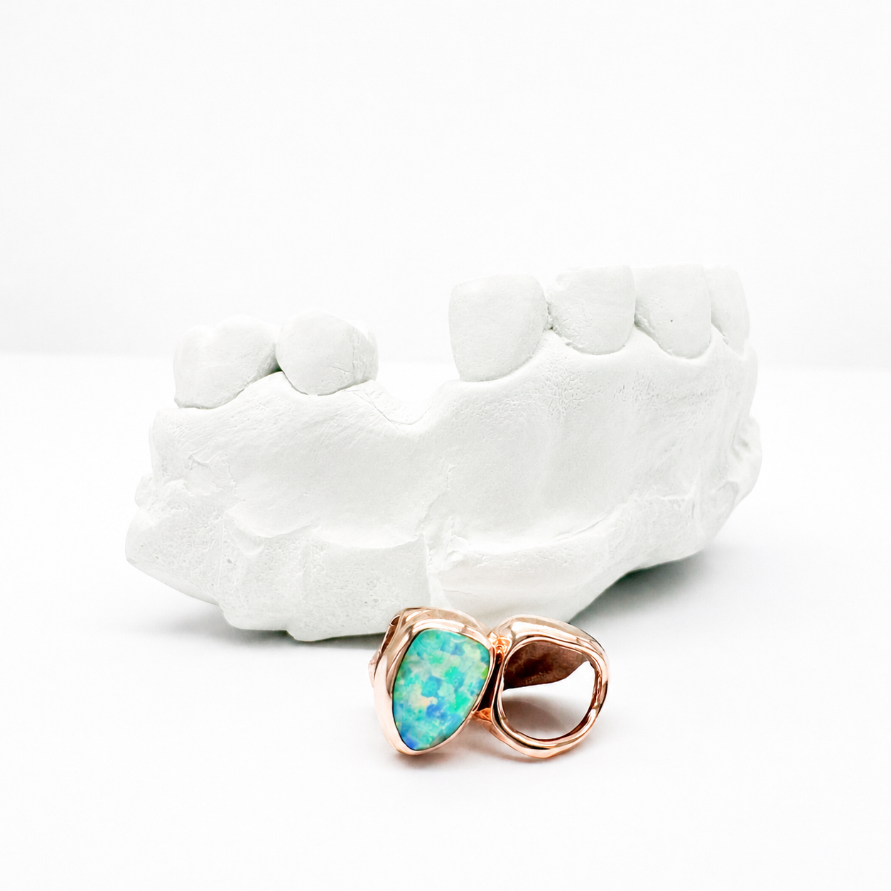 Goldteethgallery_Opalgrillz_3.png