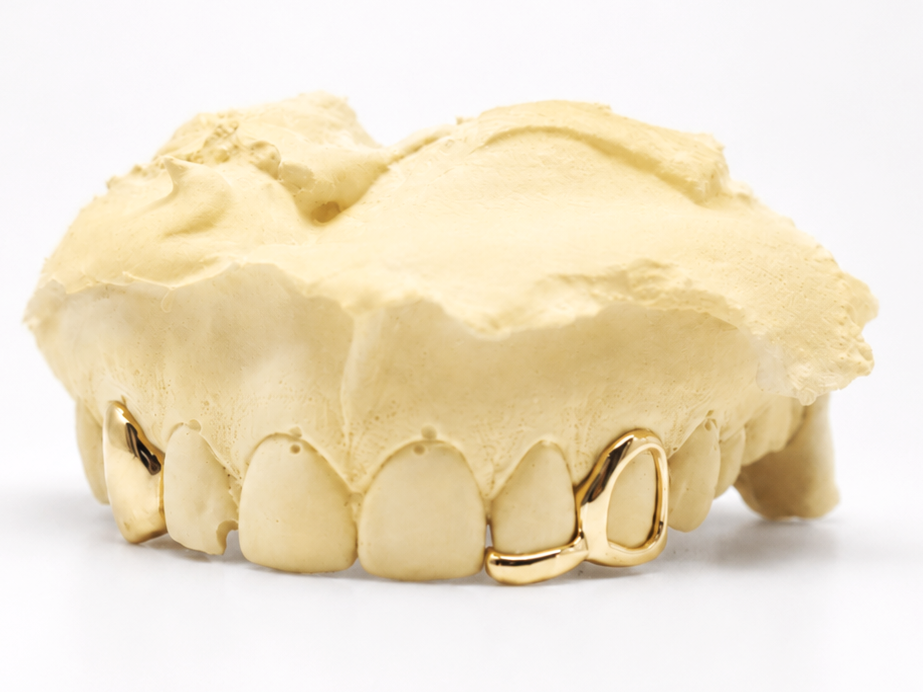 Goldteethgallery_Goldgrillz_12.png
