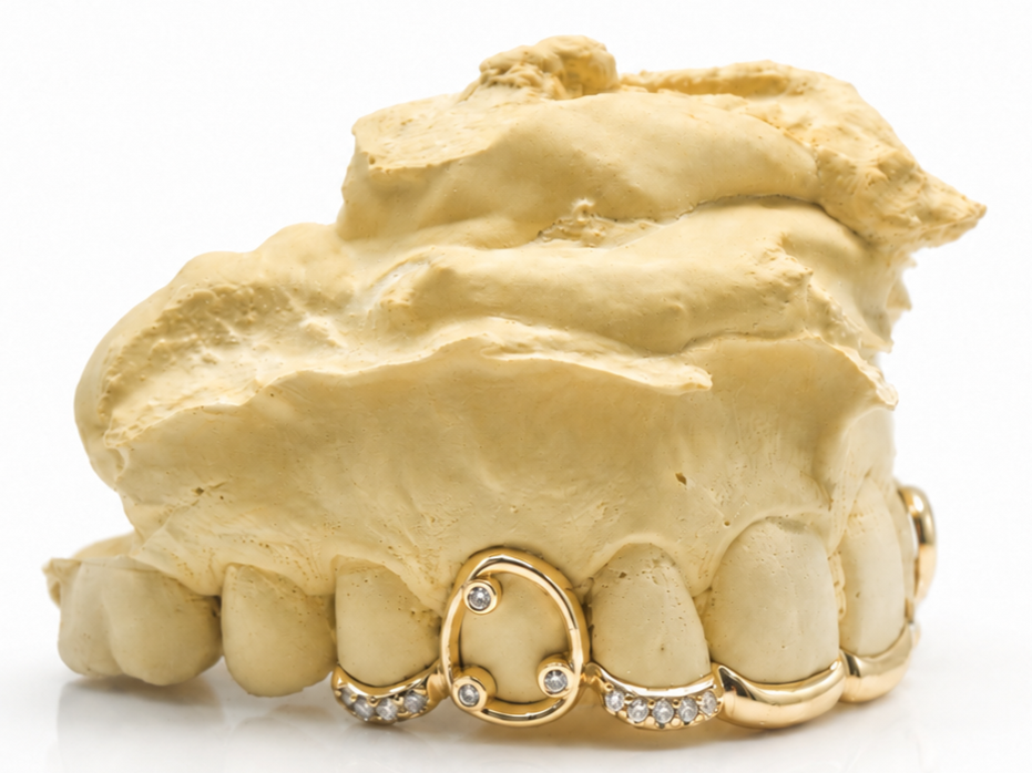 Goldteethgallery_Goldgrillz_13.png