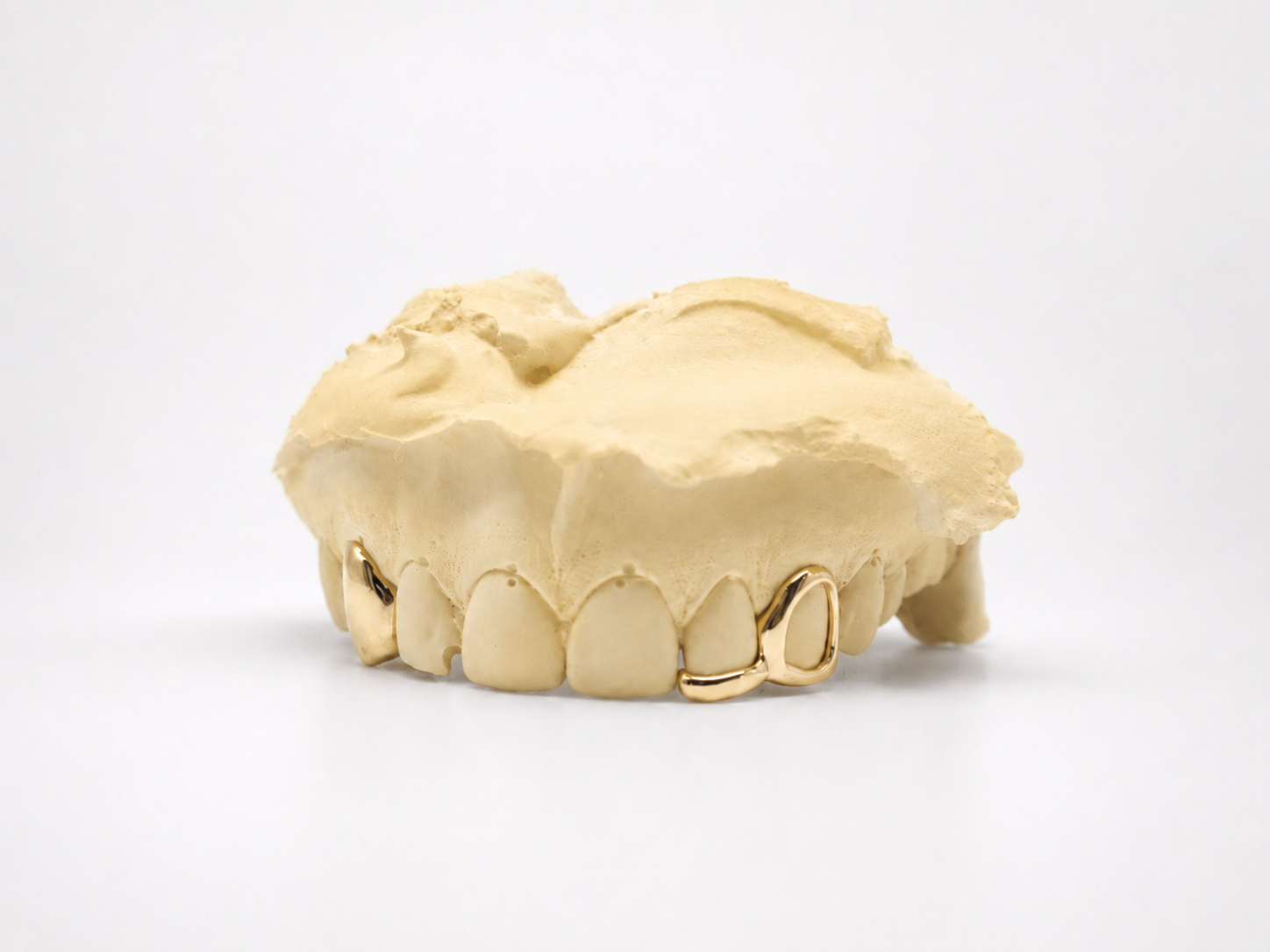 Goldteethgallery_Goldgrillz_12.png