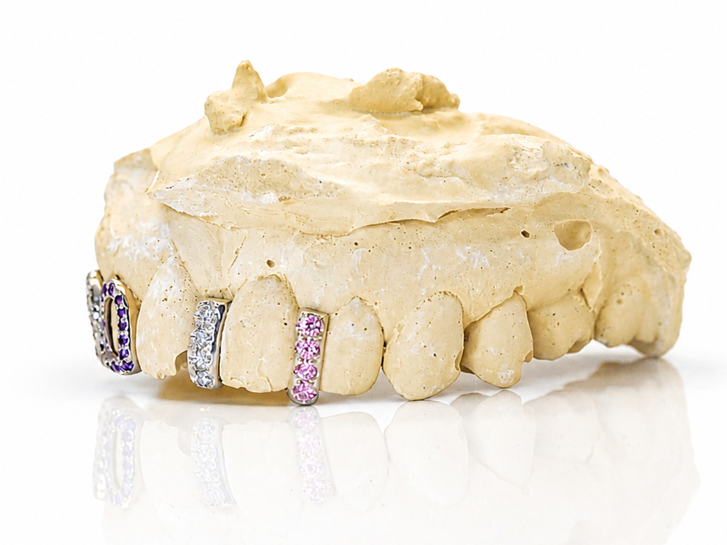 Goldteethgallery_Website-38.png