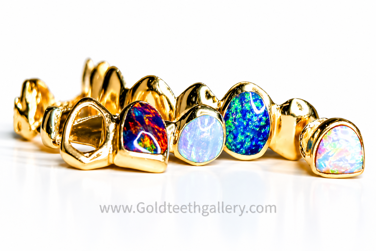 Goldteethgallery_Goldgrillz_18.png