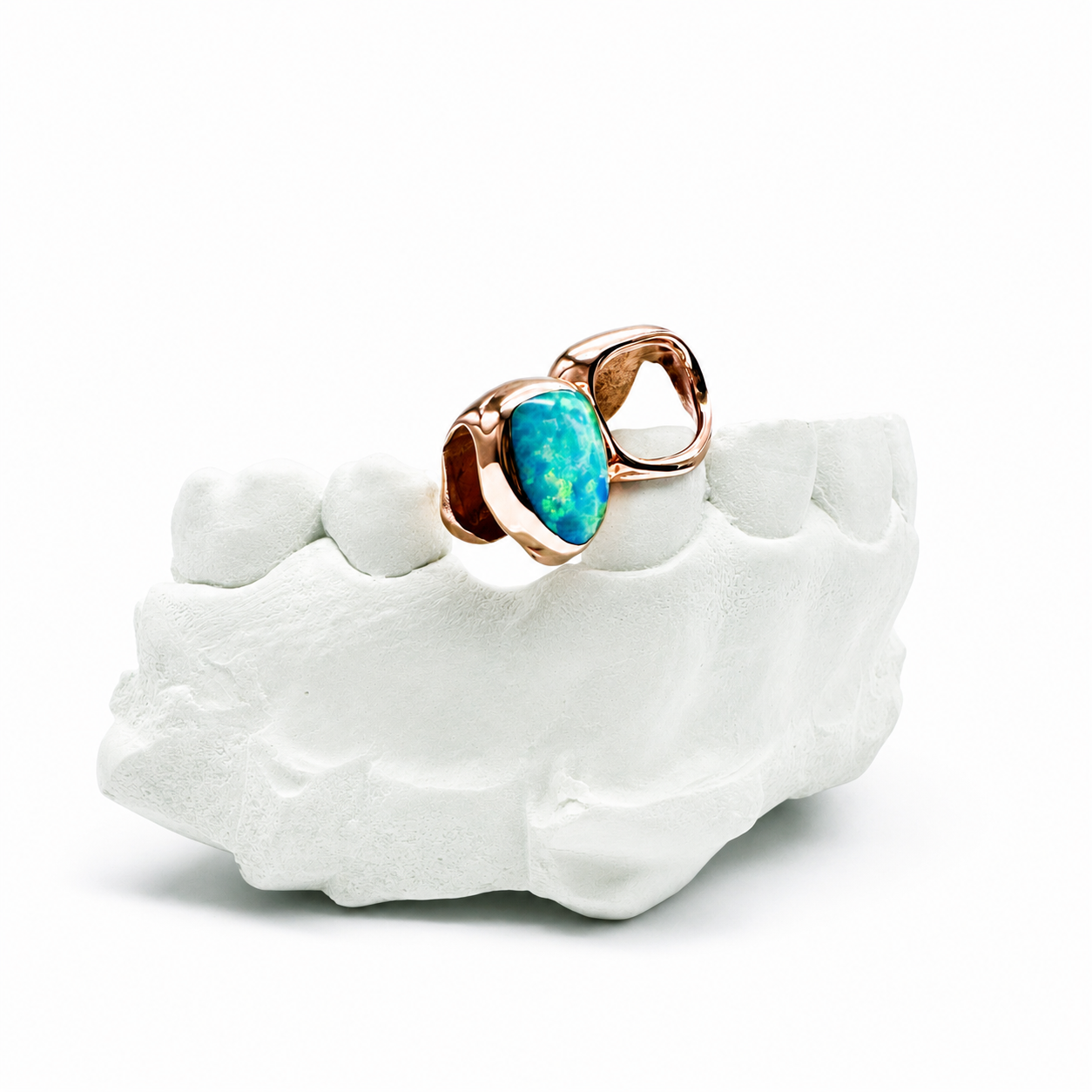 Goldteethgallery_OpalGrillz_2.png