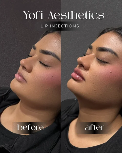 Yofi Aesthetics content creation and social media