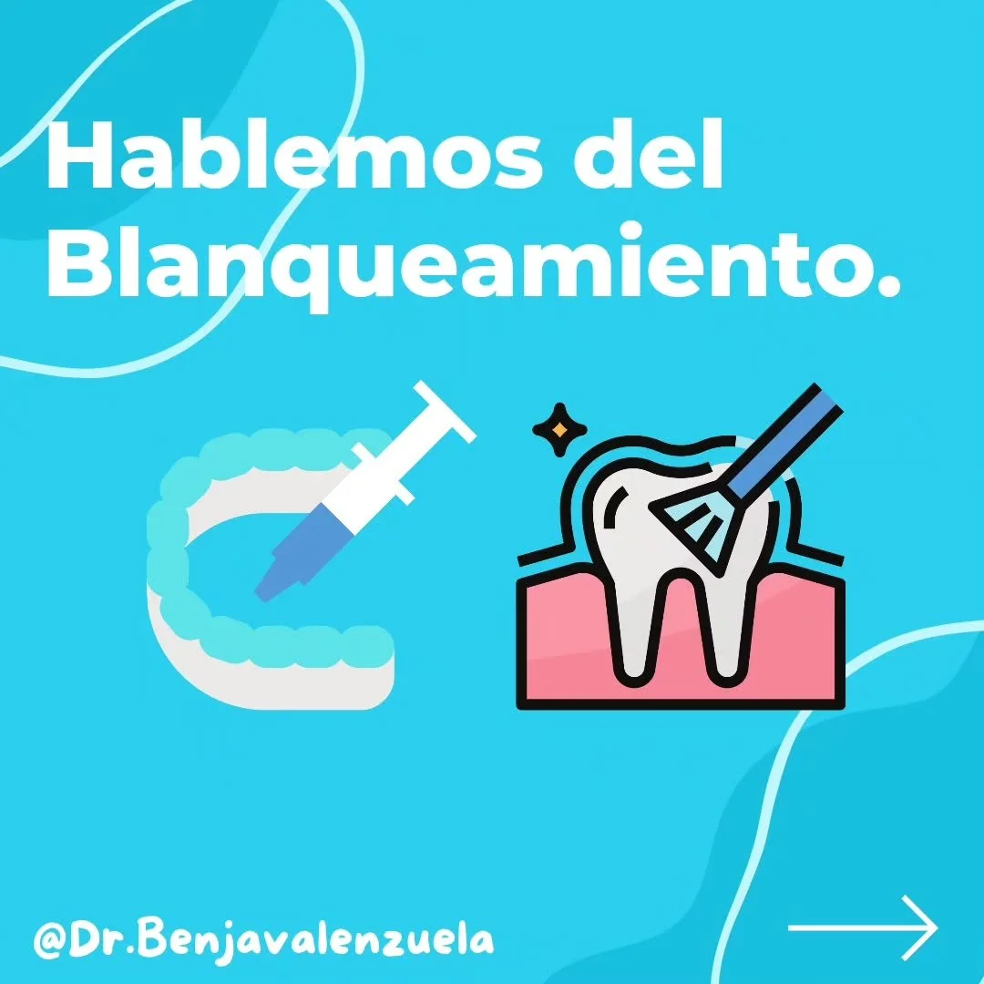 Hola a tod@s! 

A pedido de algunos, hoy hablaremos sobre un motivo de consulta bastante frecuente: El Blanqueamiento🦷 

En el siguiente post encontrar&aacute;s informaci&oacute;n sobre sus aspectos b&aacute;sicos, tipos, indicaci&oacute;nes y ver a