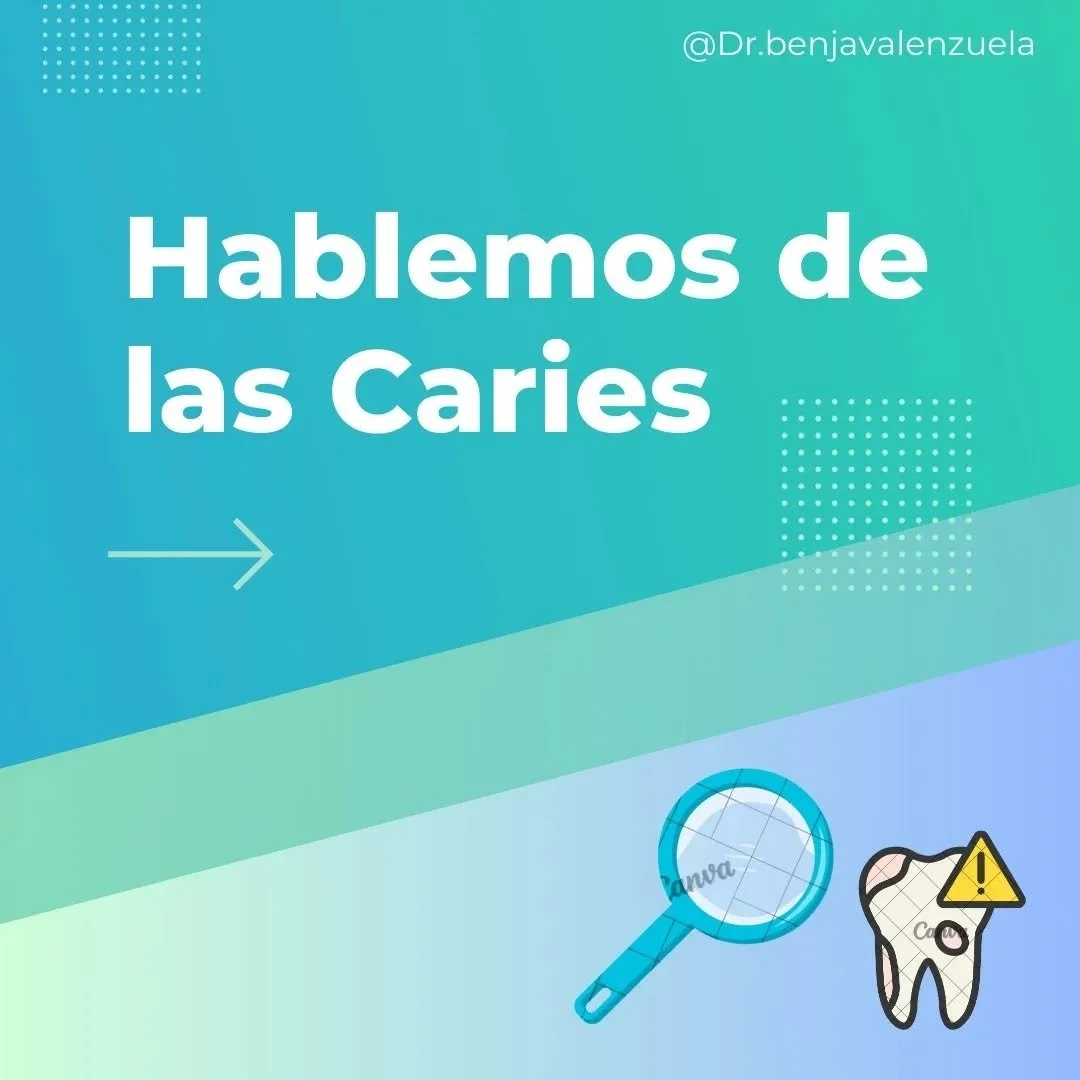 &iquest;Sab&iacute;as cu&aacute;l es el origen de las caries? 🤔🦷

En el siguiente post te explicamos qu&eacute; son, c&oacute;mo se manifiestan y los distintos tratamientos que utilizamos para combatirlas 😉🪥

&iexcl;Te invito a leerlo!👆🏼👆🏼👆?