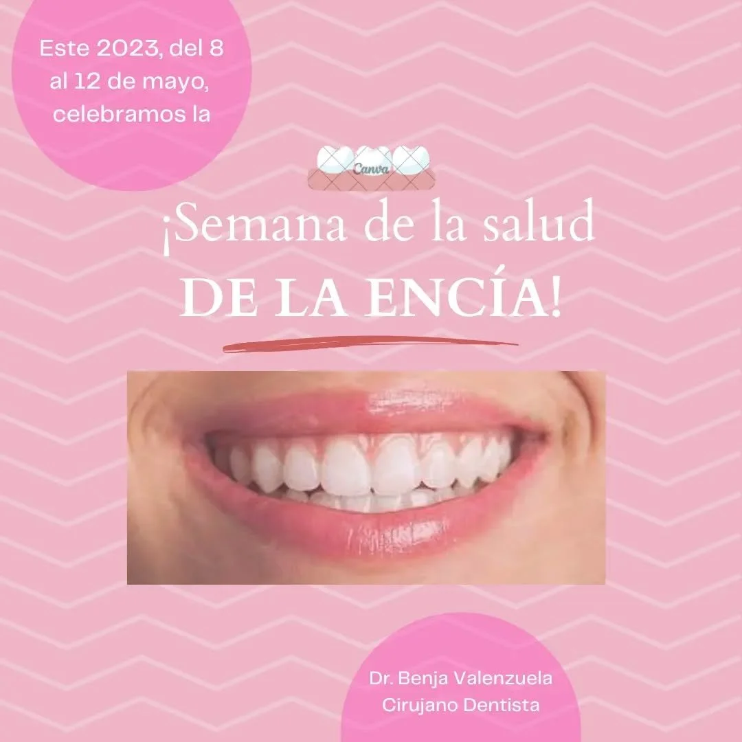 &iexcl;Estamos en la semana de la salud de la enc&iacute;a! 

Este 2023, del 8 al 12 de mayo, celebramos la semana de la salud de la enc&iacute;a para concientizar sobre nuestra salud oral. 

Saca la lengua 👅, hazte un auto chequeo y agenda tu visit