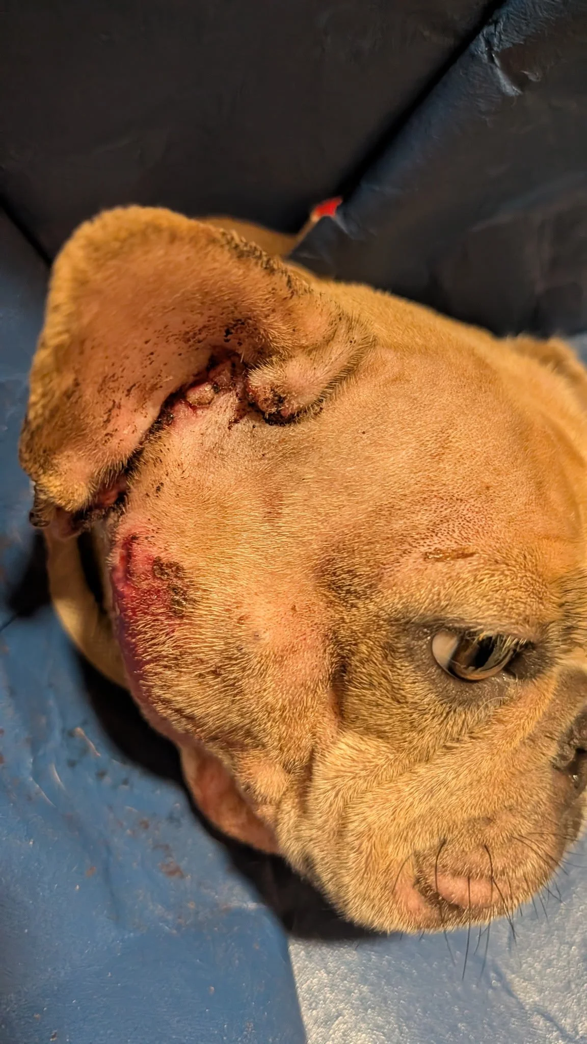 Postoperative Recovery Following TECA Surgery