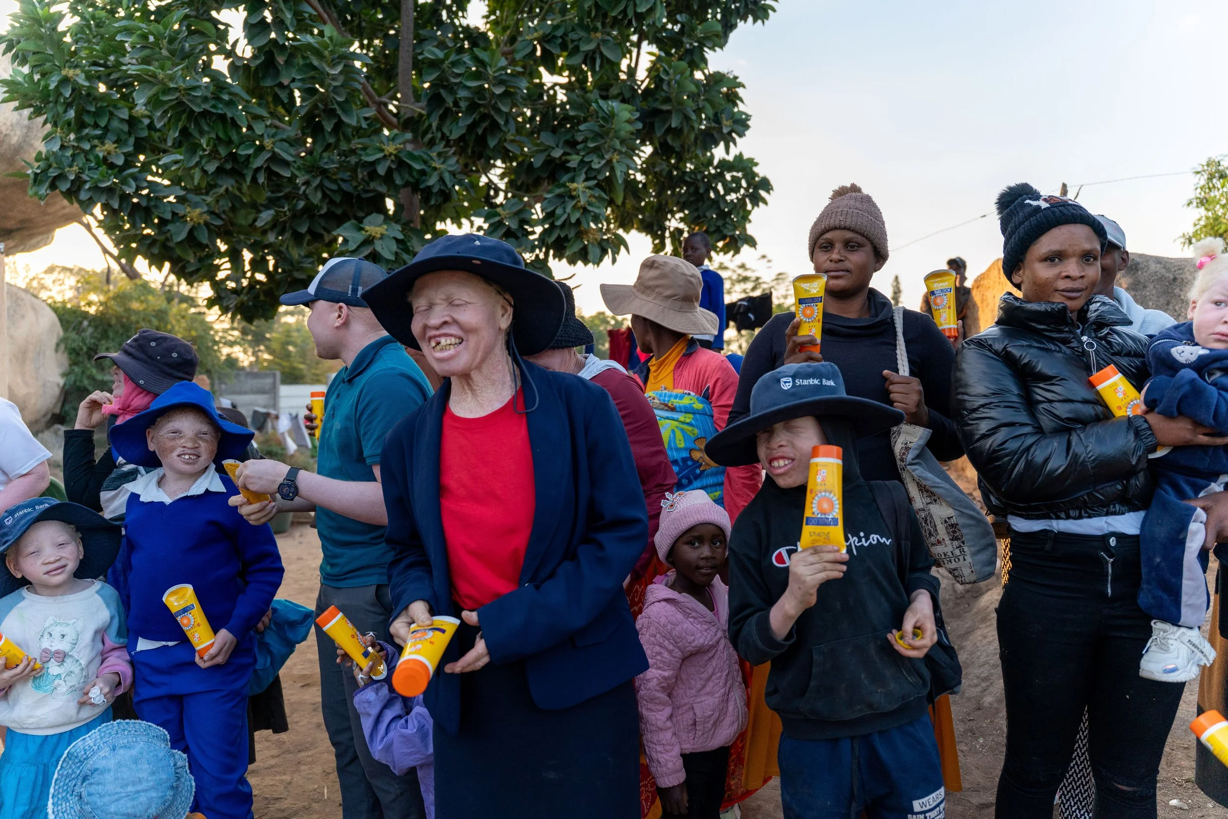 A group of Albino people after receiving sunscreen lotions in Zimbabwe