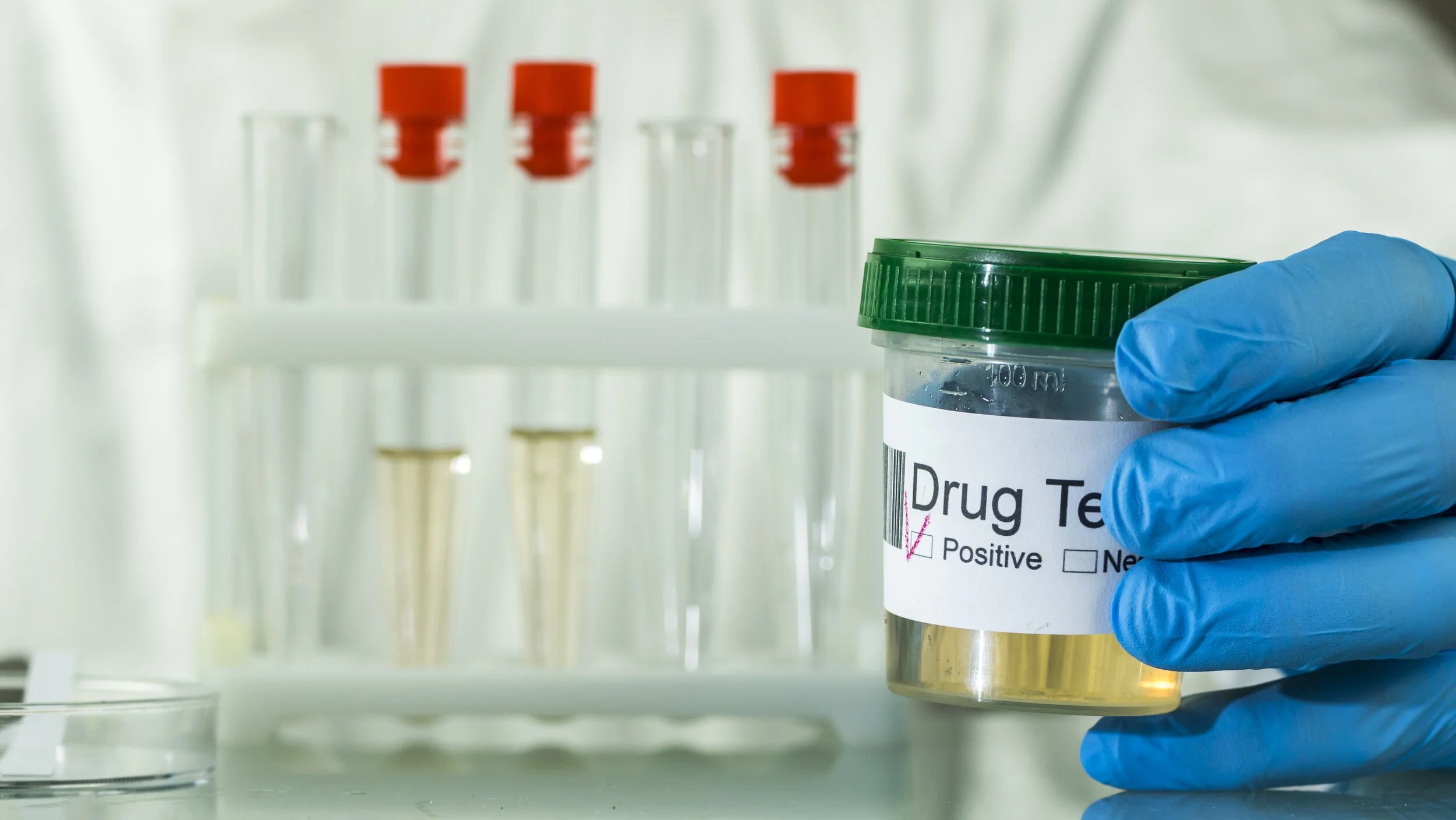 Lab-based drug testing services for employers in Long Island New York