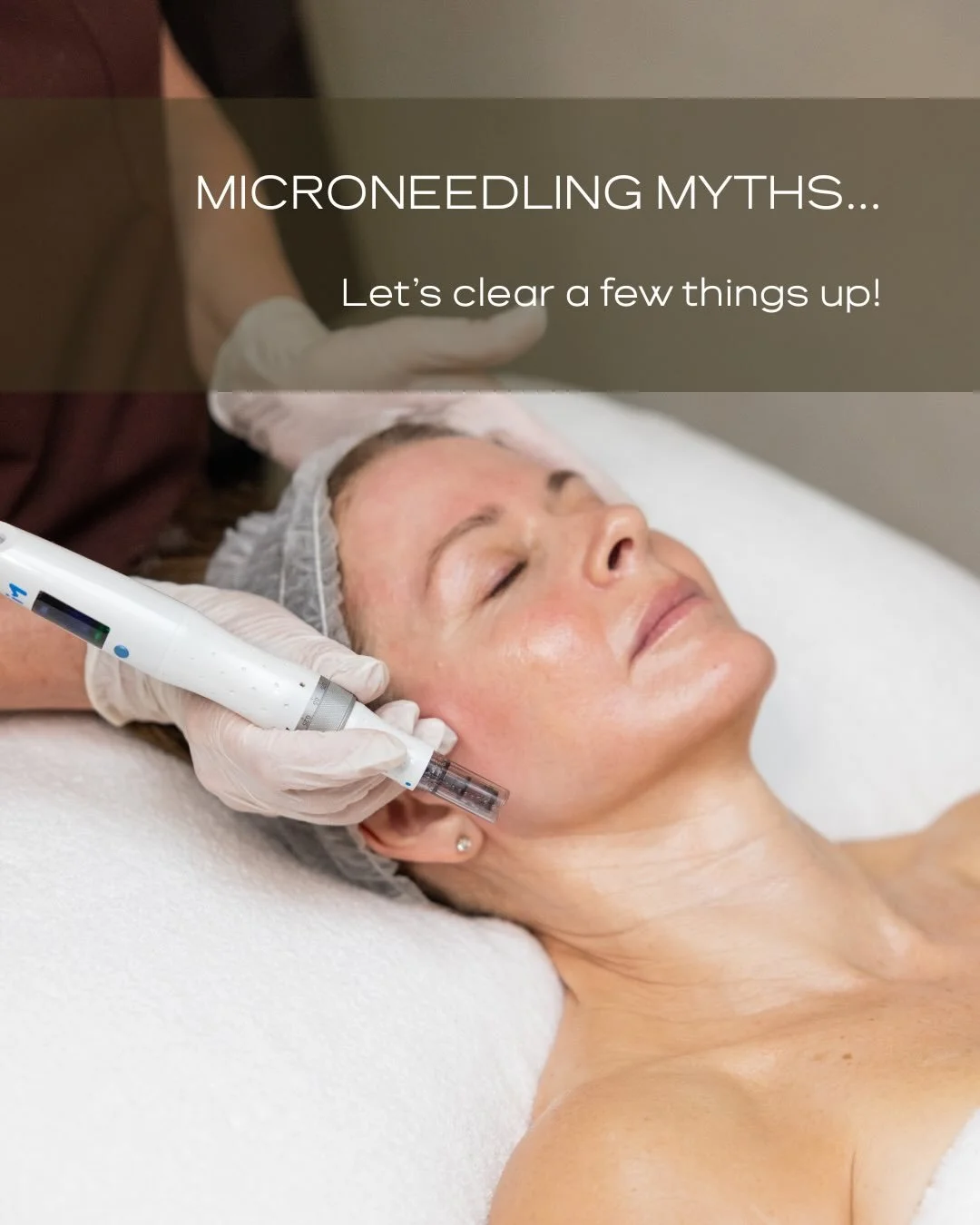 I get it &mdash; microneedling can look a little intense if you&rsquo;re new to it.

But when you strip it back to the facts, it&rsquo;s simple:
consistent treatments = stronger, healthier skin.

If you&rsquo;re curious, just send us a message.