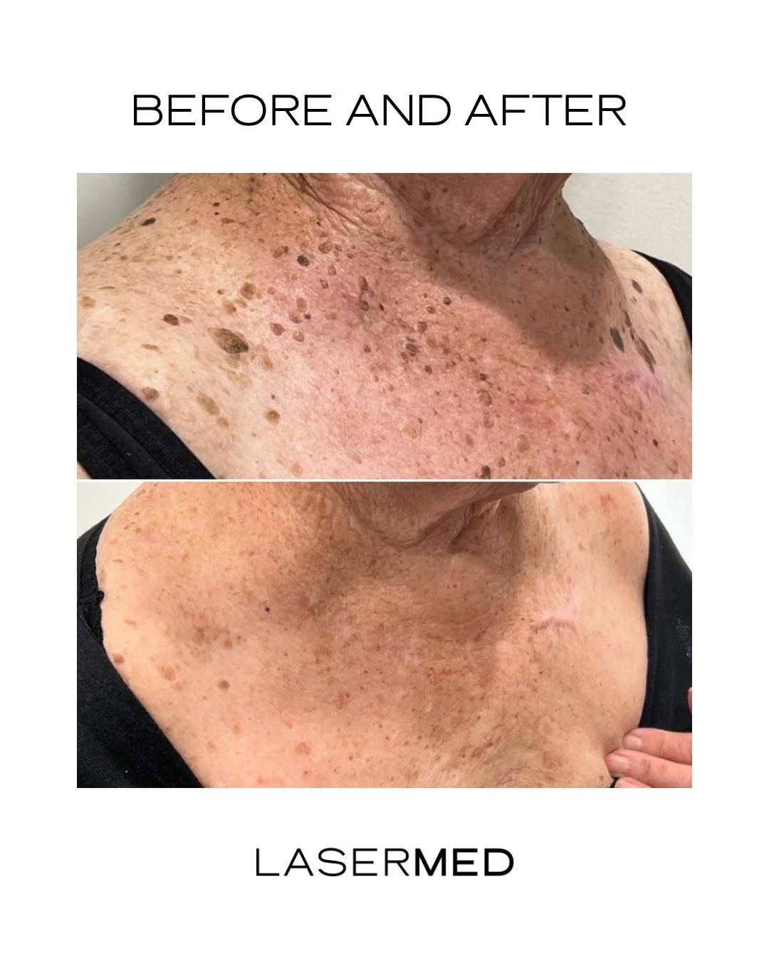 Summer&rsquo;s on the way&mdash;and feeling confident in your skin makes all the difference.

If there&rsquo;s something that&rsquo;s been bothering you, we&rsquo;re here to take a look and guide you through the safest options.

If needed, we can als