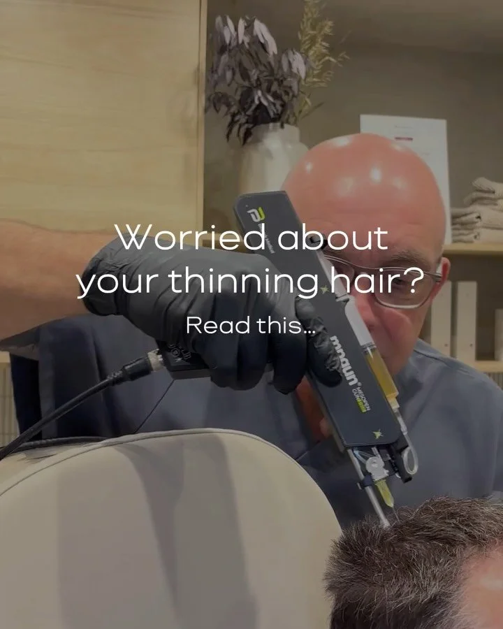 PRP stands for Platelet-Rich Plasma &mdash; a popular hair restoration treatment that uses your own growth factors to help stimulate natural hair regrowth.

We offer PRP hair restoration treatments in Portsmouth as tailored plans depending on your le