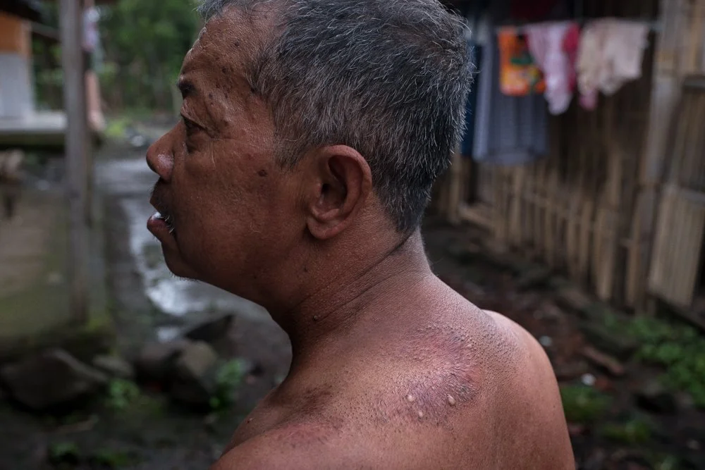 Un homme au dos abimé par le travail avec une barbe courte, vu de profil, dans une zone rurale avec des vêtements suspendus en arrière-plan.