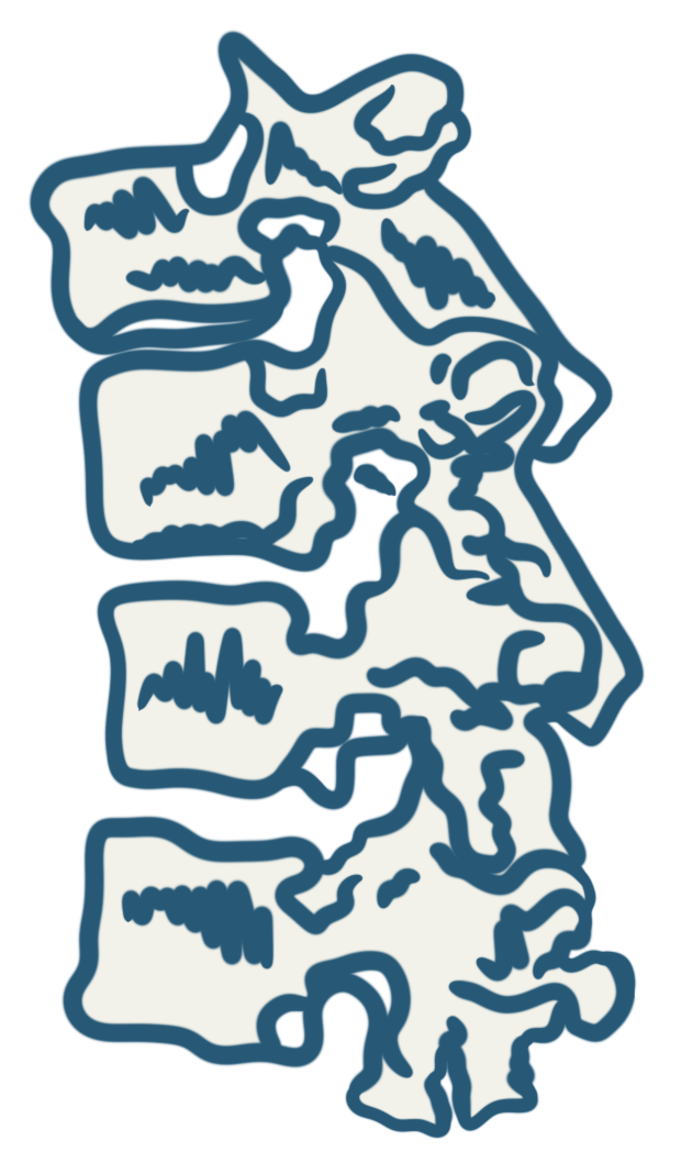 Hand illustration of the spine showing 4 vertebrae