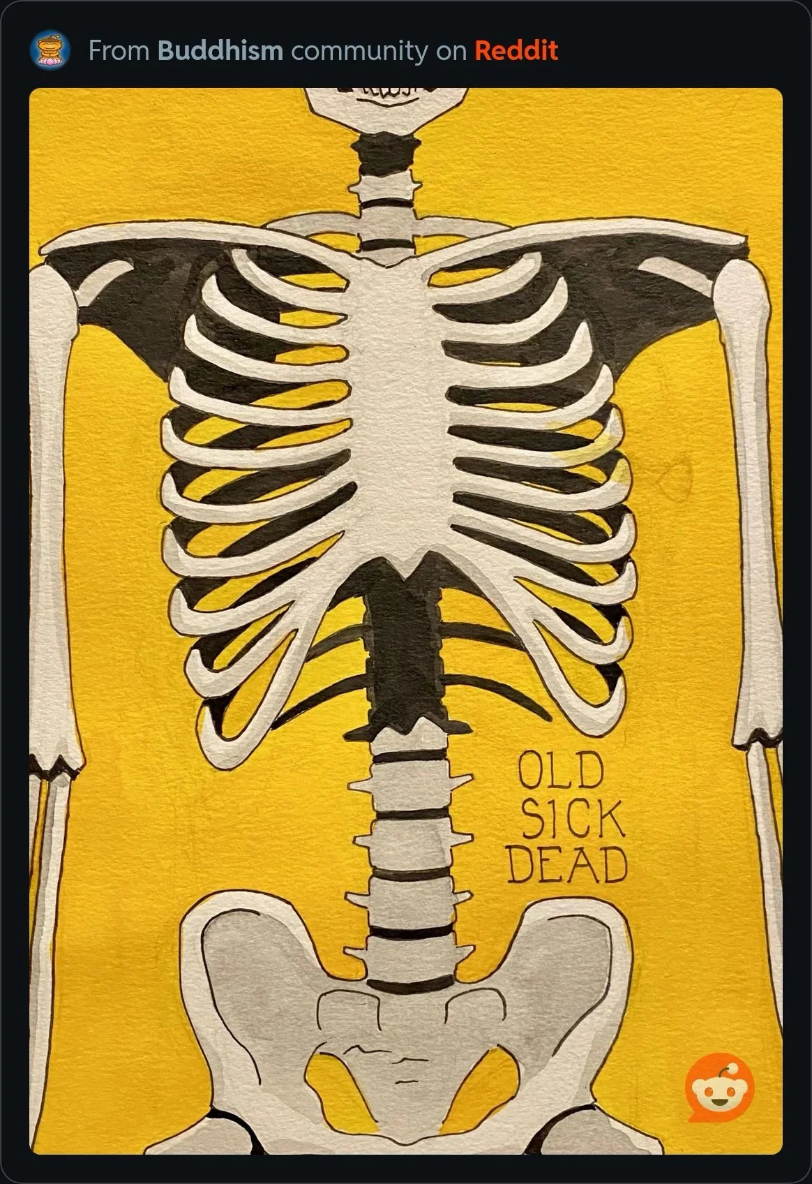 Anatomical skeleton torso and pelvis rendered in white, gray, black, and yellow with “Old Sick Dead” written beside the spine.