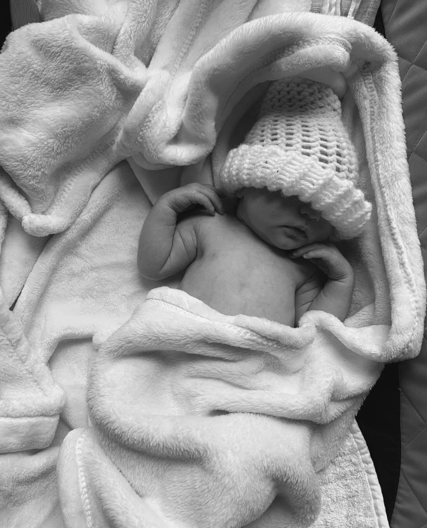 Three quick tips for parents of newborns with jaundice:

1️⃣ Feed frequently.
The more a newborn eats, the more bilirubin they clear. Frequent feeds keep everything moving in the right direction.

2️⃣ If your milk hasn&rsquo;t fully come in yet, supp