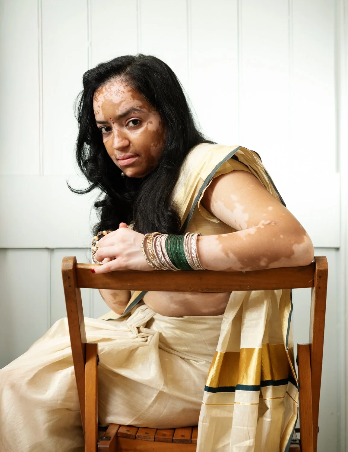 Woman with vitiligo in traditional Indian attire sitting on a chair, looking at the camera, with a neutral background.