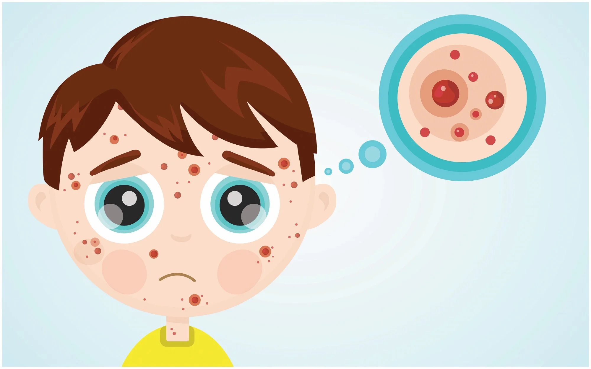 Measles, Rubella, Chickenpox…Oh My! Understanding Common Childhood Rashes