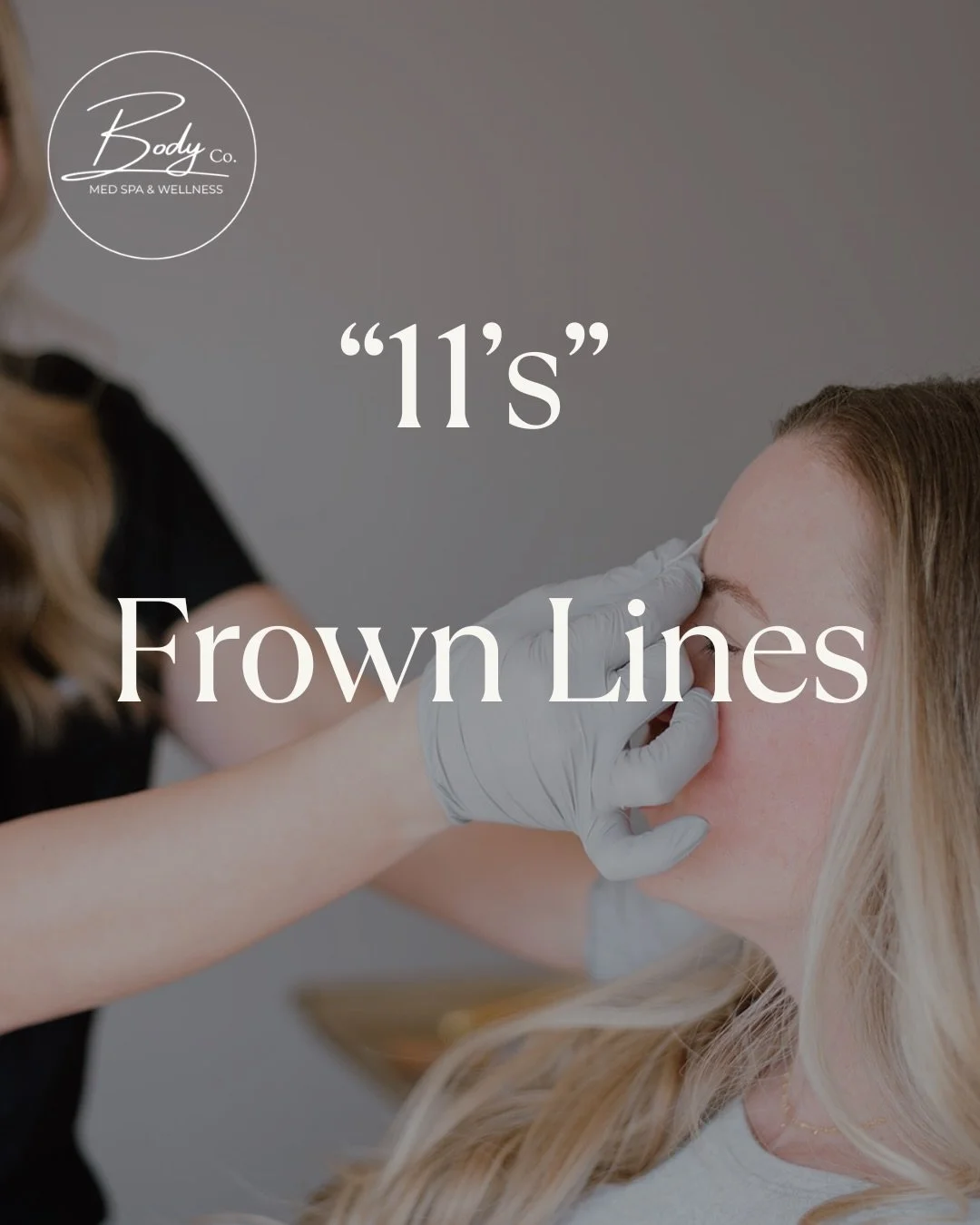 Not all 11&rsquo;s are equal-meaning if you have deep set lines it may take more than one botox session to see real results.

Lines that have been there for years need more work than if they are soft lines that have just started being formed. 

Most 