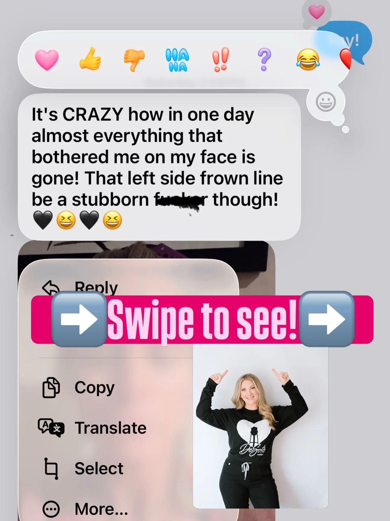 &ldquo;all the things I didn&rsquo;t like are gone&rdquo; 🫶🏻

That&rsquo;s the goal every single time.
Restored confidence.
Natural.
Refreshed.
Undetectable.
Swipe to see why 👉🏻

Tell me what you notice first in the after ⬇️

**Shared with explic