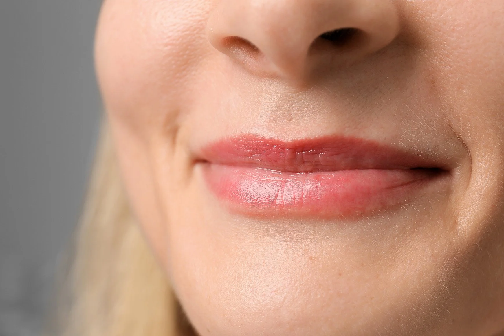 Lip Filler - Lunella Studio - Sherwood Park