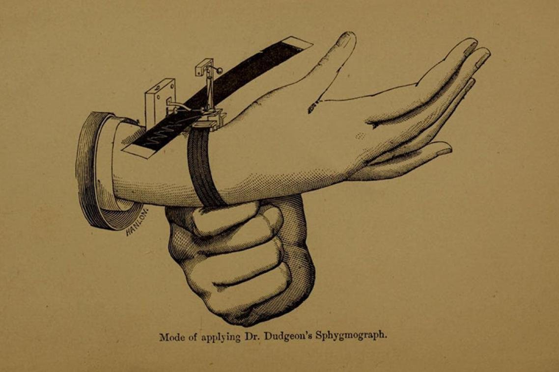 marks-hirschfield-museum-collection-sphygmograph.jpg
