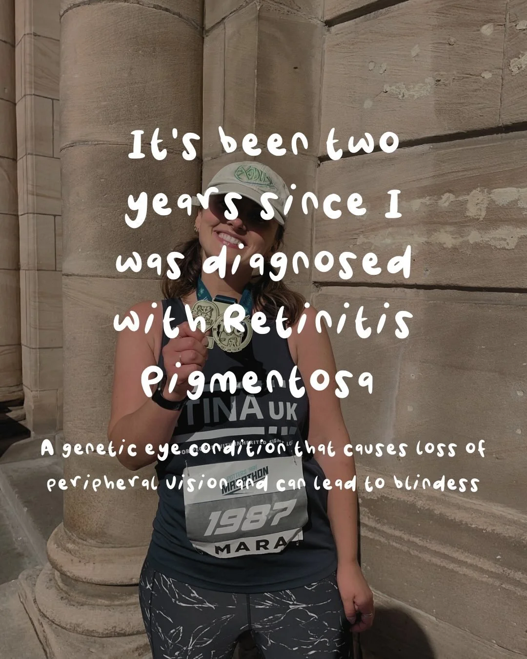 2 years since I was diagnosed April 26th a date I&rsquo;ll always remember ⭐️

Life brings challenges to us all, I hope that how I try to handle them will show my little girl Norie how to be resilient and kind to yourself, and I hope that sharing my 