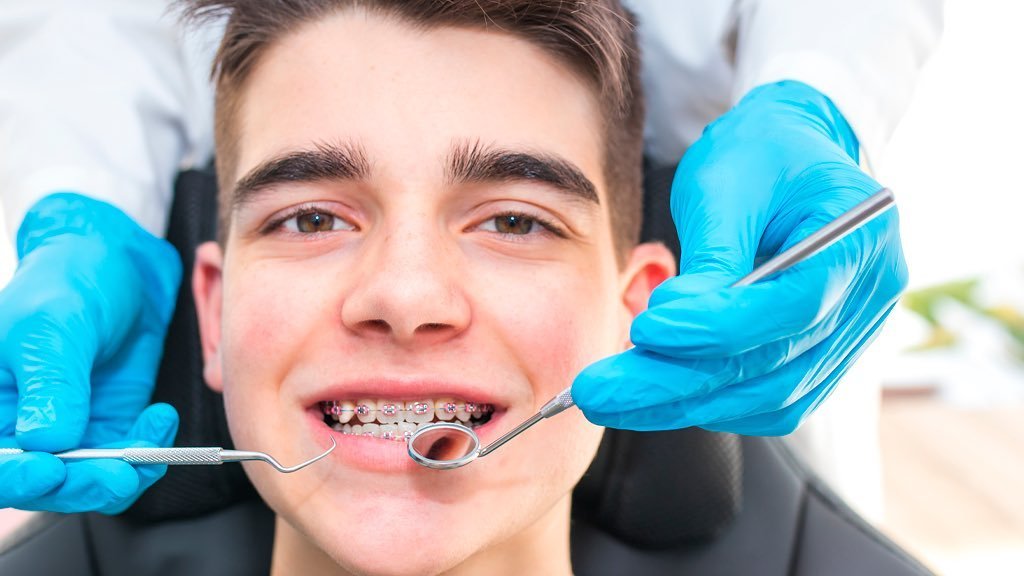 La Ortodoncia significa dientes rectos. Es la ciencia y arte que se encarga de ubicar las piezas dentales utilizando diferentes mecanismos en la posición más adecuada dentro de sus arcadas dentales para optimizar la función y est