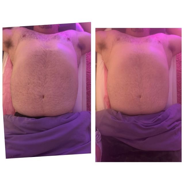 Lymphatic Drainage