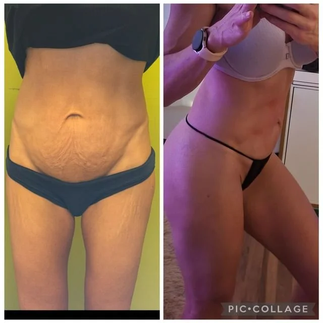 Signature Sculpt + Tighten™