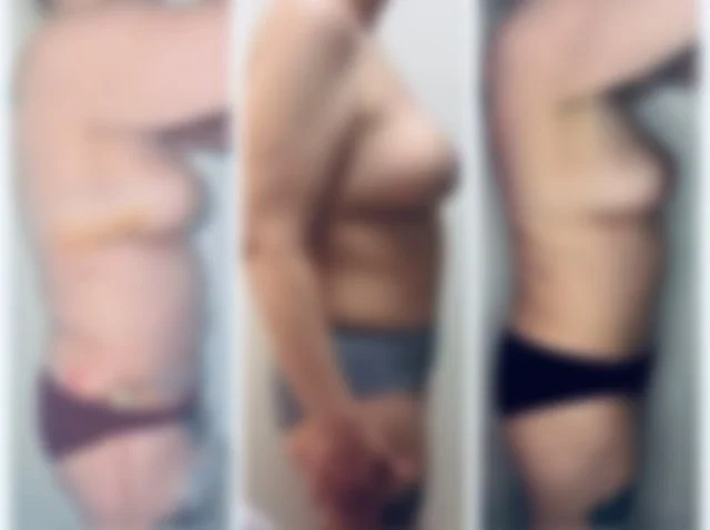 Post-Op Recovery Concierge™  60–90 Minutes