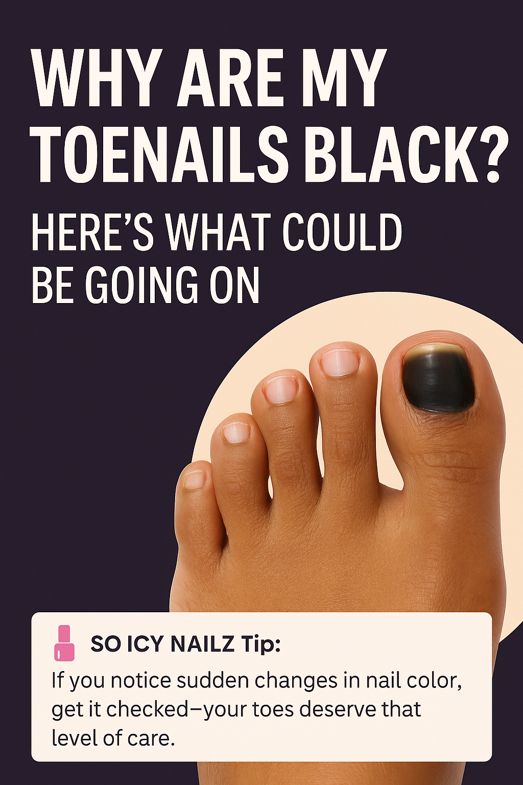 Why Are My Toenails Black? Here’s What Could Be Going On