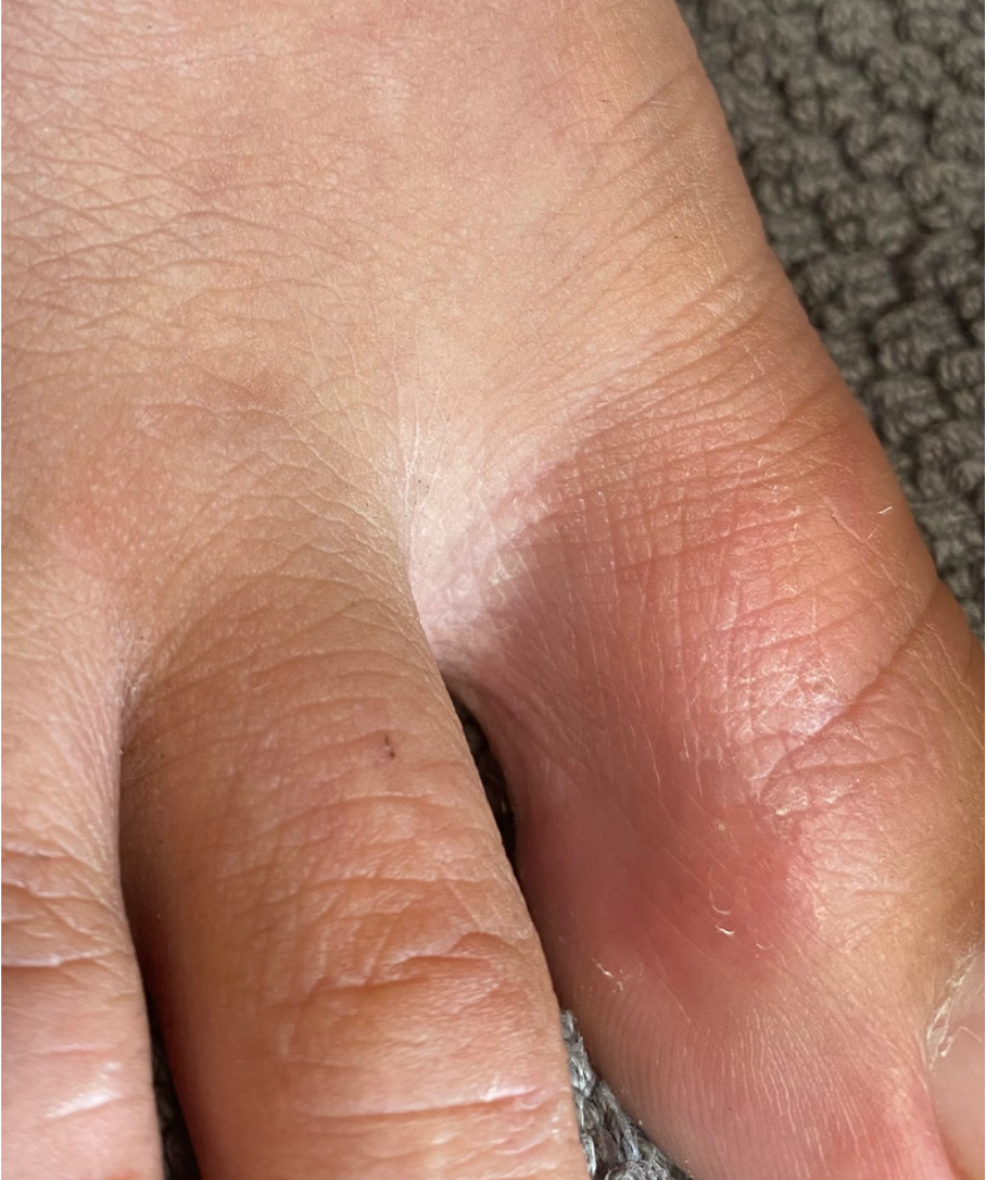Nahaufnahme eines menschlichen Fingers mit sichtbarer Hautstruktur und leichtem Rotton.