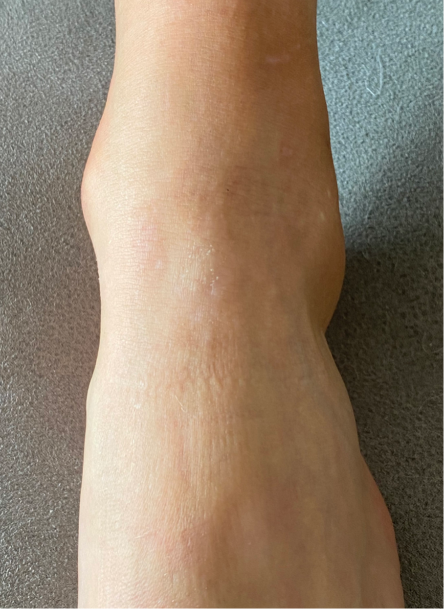Ein menschliches Handgelenk und Hand mit sichtbarer Hautstruktur, auf einer grauen Oberfläche ruhend.