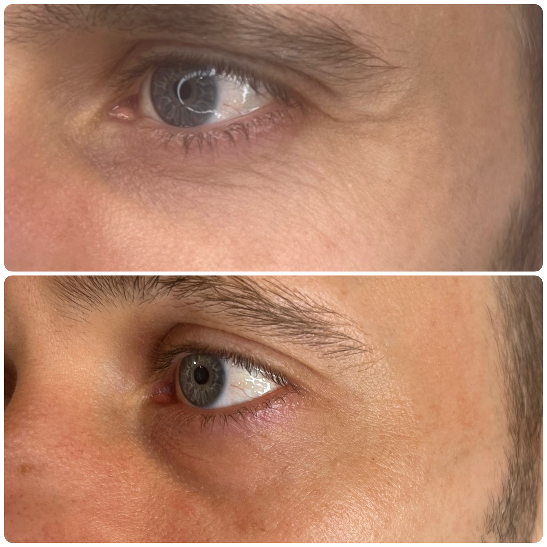 Before and after underage polynucleotide treatment Christchurch Dorset
