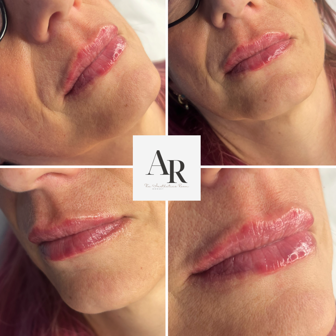 Untitled design - 1.png