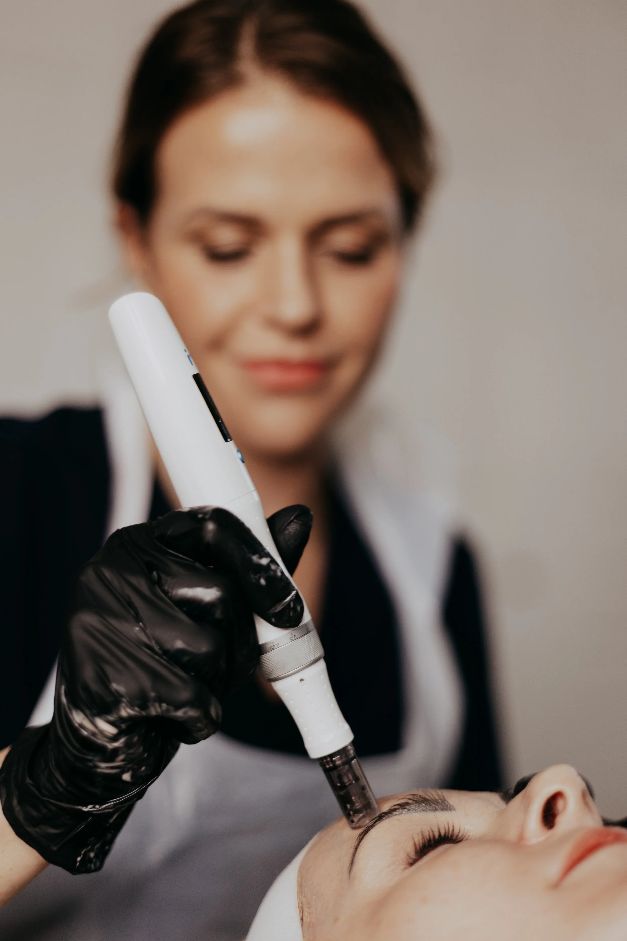 Best microneedling near christchurch Uk.